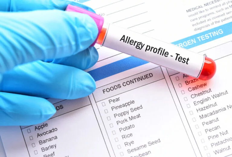 Medical lab technician holding allergy profile blood test tube over food allergen checklist form