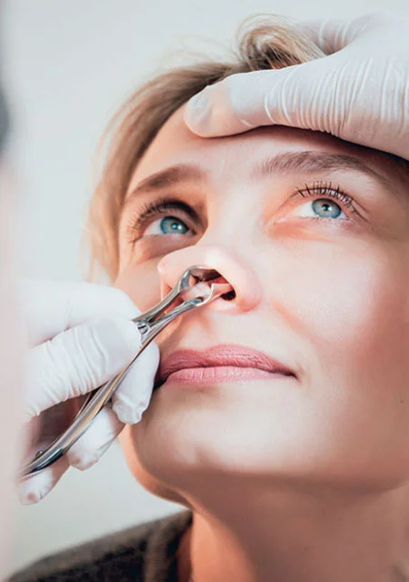ENT doctor examining female patient nose using anterior rhinoscopy speculum for nasal polyps diagnosis