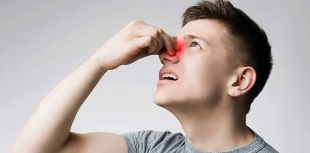 Young man pinching red inflamed nasal bridge suffering from nasal polyps obstruction at Center of ENT Lahore